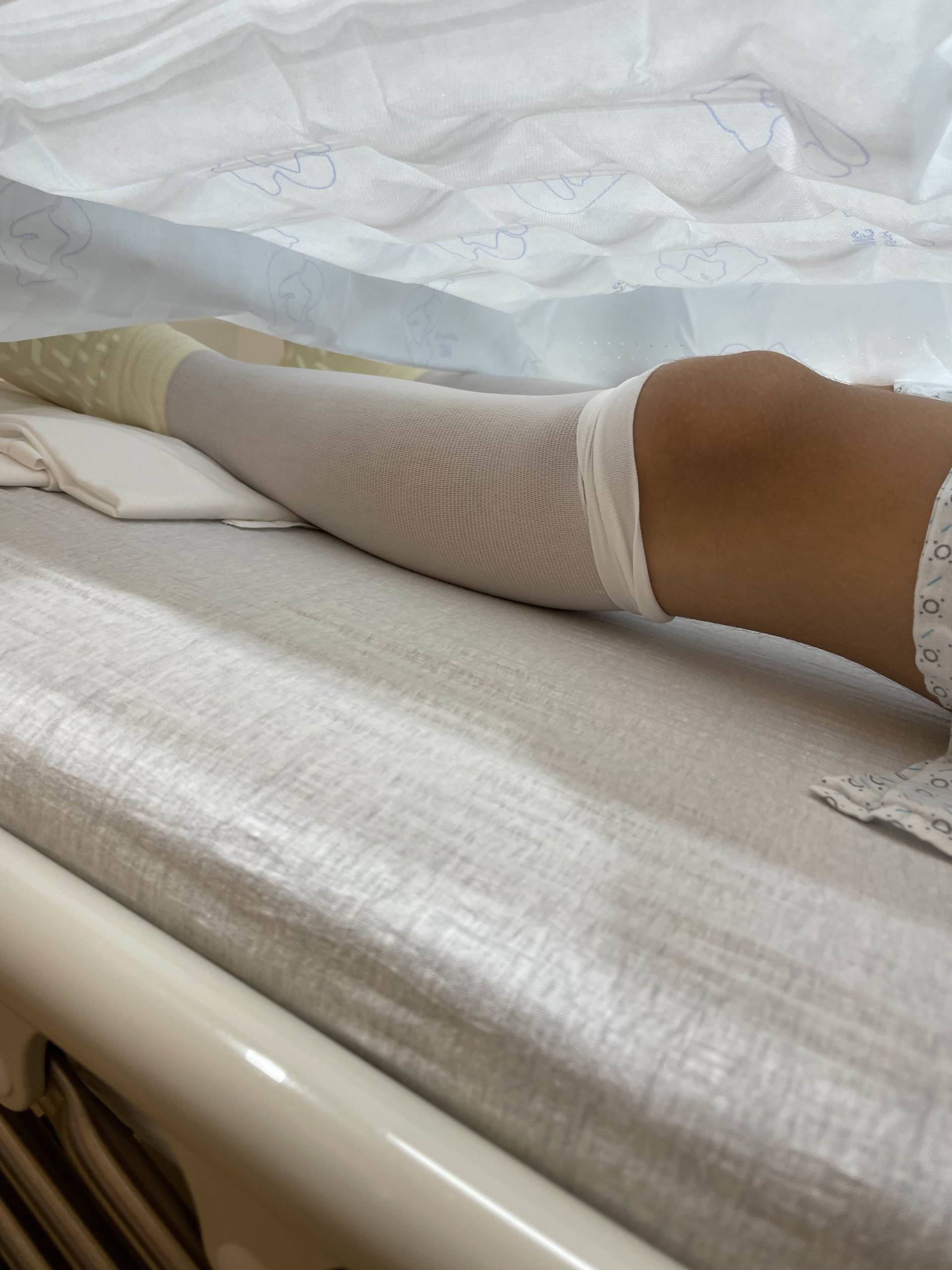 compression stockings before surgery